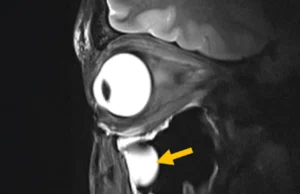 Nova descoberta de ressonância magnética revela cérebro e olhos como nunca antes