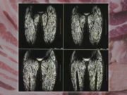 Verificação de fatos: As varreduras supostamente mostram o corpo de uma mulher infectado com parasitas por comer carne de porco crua por uma década. Aqui está a verdadeira história