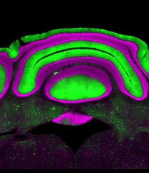 purkinje-cell-activity.webp