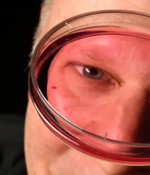 robert-johnston-retinal-organoid.webp