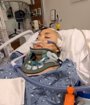 110914507-16087171-Pamela_Guillen_40_suffered_severe_brain_hemorrhages_after_riding-a-2_178793865777.avif