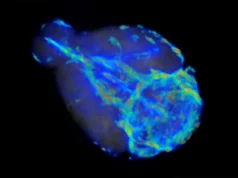 Os cientistas descobriram que o cérebro tem uma via rápida e uma via lenta para eliminar os resíduos.