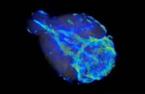 Os cientistas descobriram que o cérebro tem uma via rápida e uma via lenta para eliminar os resíduos.
