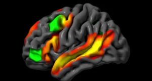 Neurocientistas do MIT descobrem que o cérebro pode raciocinar sem palavras