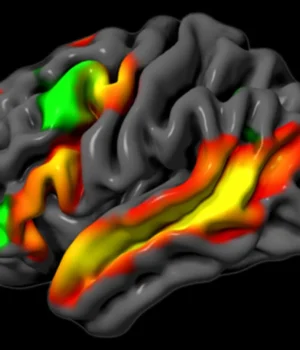 functional-brain-scan-neurotypical-participant.webp