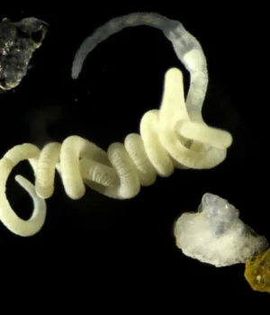 gutless-marine-worm-olavius-algarvensis.webp