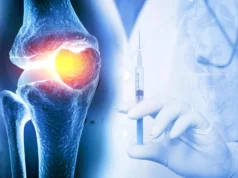 Uma injeção pode manter os medicamentos para osteoartrite funcionando por semanas