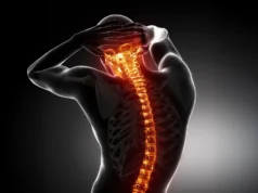 Um medicamento já utilizado para a osteoporose evitou danos na medula espinhal num novo estudo.
