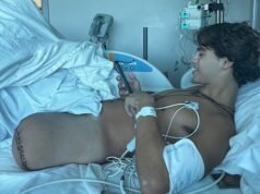Sobrevivente em crise: alegações explosivas sobre cocaína no set para manter os competidores ‘sóbrios’ e acidente horrível que amputa a perna do vencedor