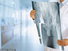 Medicamento experimental contra o câncer pode parar a osteoporose e ajudar as mulheres a permanecerem magras após a menopausa