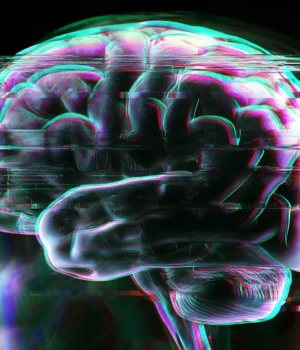 brain-scan-glitch-disease.webp