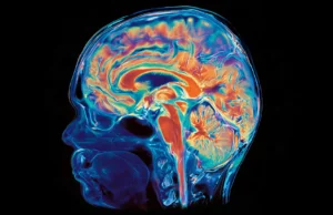Estudo raro revela uma divisão surpreendente dentro do cérebro de um paciente com Alzheimer