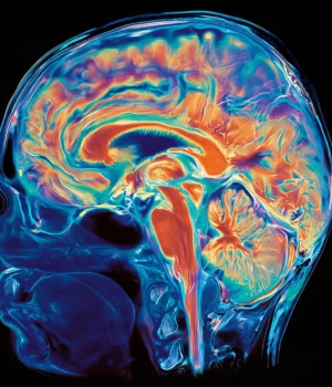 brain-scan-mri.webp