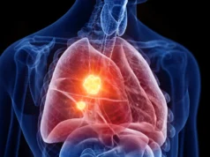 Novo medicamento para mesotelioma altera sua própria defesa contra o câncer