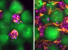 Cientistas do MIT desenvolvem “mini fígado” injetável que funciona dentro do corpo