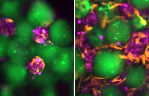 Cientistas do MIT desenvolvem “mini fígado” injetável que funciona dentro do corpo