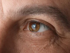 Cialis associado a maior risco de glaucoma em grande estudo
