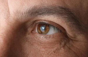 Cialis associado a maior risco de glaucoma em grande estudo