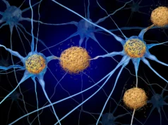 Alzheimer pode deixar cicatrizes no cérebro muito antes do aparecimento de placas