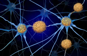 Alzheimer pode deixar cicatrizes no cérebro muito antes do aparecimento de placas