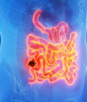 male-anatomy-small-intestine-cancer.webp